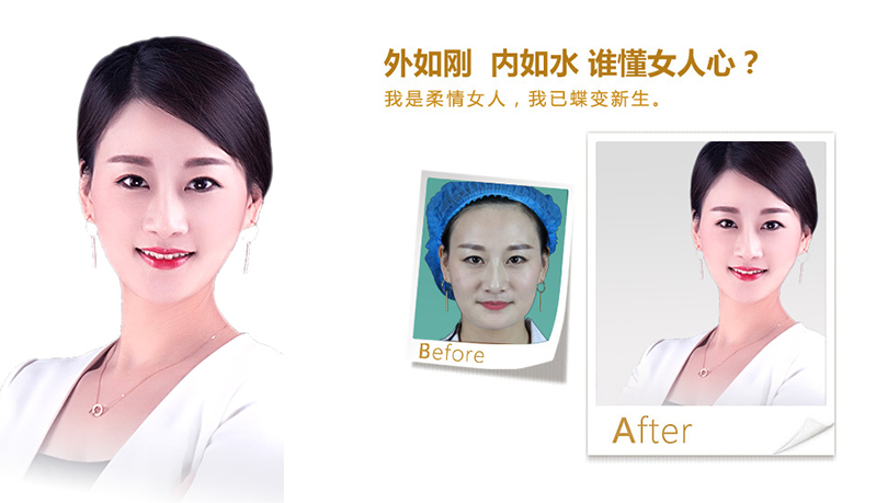 南平V脸、线雕隆鼻